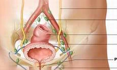 Phòng ngừa viêm đường tiết niệu