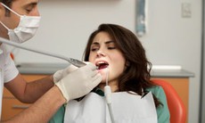 Nguy hiểm răng khôn mọc "dại"