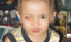 Bầm mắt, lồi mắt…có thể là triệu chứng báo động ung thư trẻ em