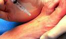 Thuốc gây tê - đôi điều cần lưu ý