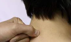 Đông y chữa viêm xoang mũi, tắc mũi
