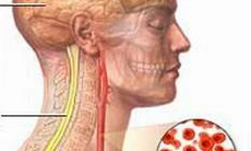 Có nên tiêm thuốc phòng bệnh mất trí nhớ?