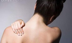 Có chữa khỏi viêm da tiết bã nhờn?