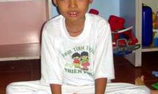 Điều trị loạn dưỡng cơ