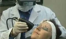 Ứng dụng laser trong điều trị các bệnh da liễu