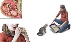 Bệnh nhiễm toxoplasma