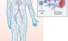 Bệnh u lympho ác tính không Hodgkin