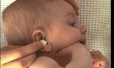 Nhận biết trẻ bị viêm tai giữa cấp