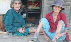 Bệnh phong có đáng sợ?