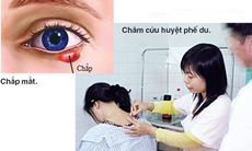 Chích lể chữa chắp mắt
