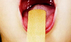 Viêm họng có cần đến corticosteroid?