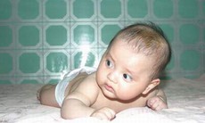 Thóp trẻ thở "phập phồng" có nguy hại?