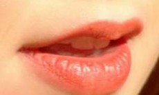 Nẻ môi do thuốc?
