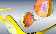 Một số công nghệ đột phá trong y học