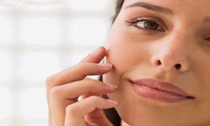 Rối loạn tăng sinh sắc tố da khu trú
