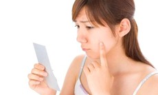 Thuốc điều trị mụn trứng cá và những chú ý khi dùng