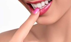 Những thực phẩm cho hàm răng chắc khỏe