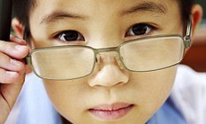 Ai nên phẫu thuật lasik chữa cận thị?