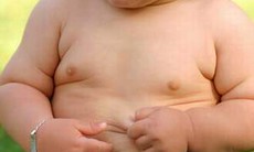 Biến dạng xương khớp vì béo phì