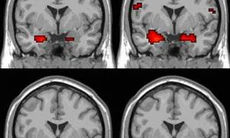 Phát hiện mới về oxytocin