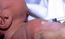 Tiêm phòng lao cho trẻ có gì đặc biệt?