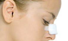 Các biến chứng thường gặp sau nâng mũi