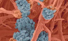 Không sử dụng thực phẩm bị nấm mốc