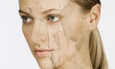 Xóa nhăn da - cách gì?