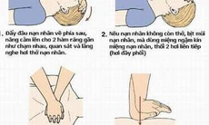 Cách hô hấp nhân tạo và xoa bóp tim ngoài lồng ngực