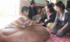 Người mọc lông, bộ phận cơ thể to bất thường: Hiện tượng kỳ lạ chờ giải đáp