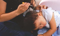 Nút ráy tai khô ở trẻ