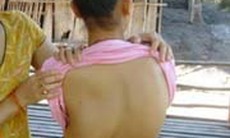 Ngăn ngừa cong vẹo cột sống ở trẻ em