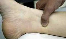 Day bấm huyệt tam âm giao chữa bệnh