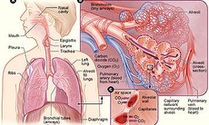 Tắc động mạch phổi cấp - Bệnh lý nguy hiểm