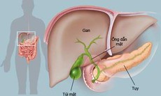 Biến chứng nguy hiểm do áp-xe gan