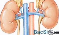 Cách tránh tái phát hội chứng Cushing