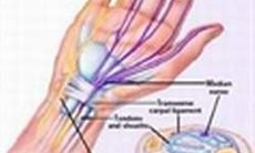 Bước tiến mới trong điều trị bệnh rối loạn trương lực cơ