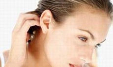Viêm chân tóc, chữa thế nào?
