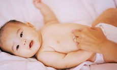 Dấu hiệu sớm phình đại tràng bẩm sinh