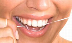 Cách tẩy trắng răng hiệu quả