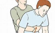 Cấp cứu dị vật đường thở