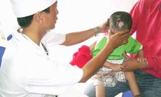Dùng cotrimoxazol dự phòng nhiễm trùng cơ hội