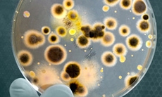 Cảnh báo bệnh viêm phổi cấp do Legionella