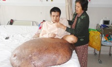 U xơ thần kinh - Bệnh hiếm gặp và kỳ lạ