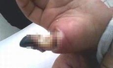 Cha mẹ bất cẩn… con phải nhập viện