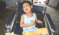 Phát hiện gen gây bệnh động kinh ở trẻ em