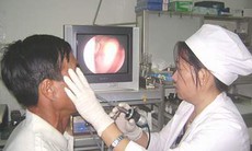 Dấu hiệu sớm của ung thư mũi xoang