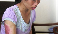 Bị chồng tưới xăng đốt, vợ vẫn viết đơn xin khoan hồng