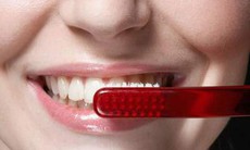 Chớ chủ quan với bệnh viêm lợi