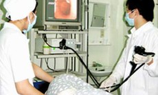 Thắt giãn tĩnh mạch thực quản và cắt polýp dạ dày đại tràng qua nội soi